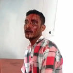 পরিচারিকার স্বামীর দা কোপে রক্তাক্ত বাড়ির মালিক, খোয়াইয়ে চাঞ্চল্য