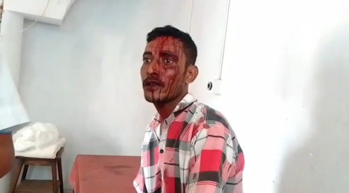 পরিচারিকার স্বামীর দা কোপে রক্তাক্ত বাড়ির মালিক, খোয়াইয়ে চাঞ্চল্য