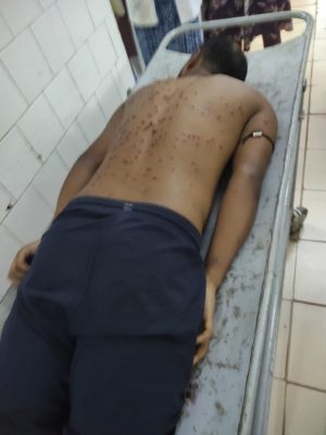 বিএসএফের গুলিতে গুরুতর আহত পাচারকারী