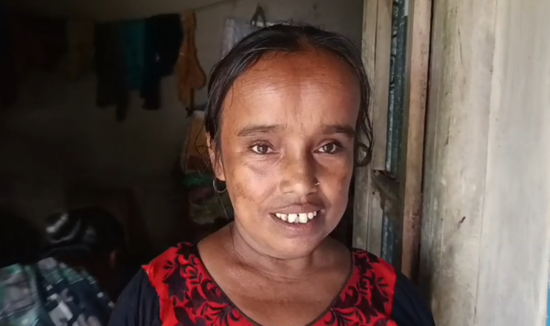 ৭৫ শতাংশ প্রতিবন্ধী প্রতিমা সরকারের&hellip;