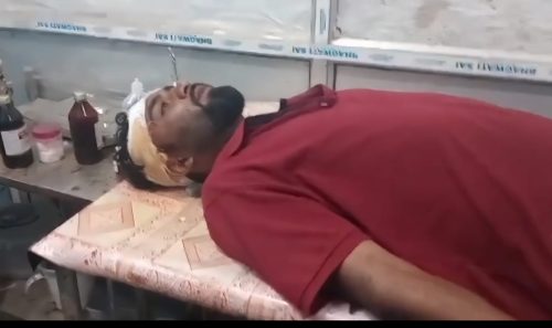 ঠিকাদারি বিবাদ ঘিরে কৈলাসহরে রক্তক্ষয়ী সংঘর্ষ, এক ঠিকাদার গুরুতর আহত