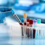 কৈলাসহর হাসপাতালের রক্ত পরীক্ষা বন্ধ, রোগীরা বিপাকে