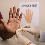 বিনামূল্যে নির্ণয় ও মাল্টি-ড্রাগ থেরাপি, কুষ্ঠমুক্ত ভারতের লক্ষ্যে অগ্রগতি: কেন্দ্র