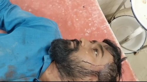 কিস্তির টাকা তুলতে গিয়ে গ্রাহকের পরিবারের হামলায় আহত ফাইন্যান্স সংস্থার কর্মী