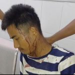 ভোট ঘনাতেই ফের সন্ত্রাসের অভিযোগ সাব্রুমে, আহত বিজেপি কর্মী