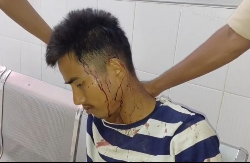 ভোট ঘনাতেই ফের সন্ত্রাসের অভিযোগ সাব্রুমে, আহত বিজেপি কর্মী