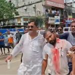 কেন্দ্রীয় শিক্ষামন্ত্রীর পদত্যাগের দাবিতেযুব কংগ্রেসের বিক্ষোভ, উত্তেজনা, জলকামান ও লাঠিচার্জ পুলিশের, আহত একাধিক
