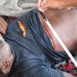 অশ্বিনী মার্কেটে রক্তাক্ত অবস্থায় দিনমজুরের দেহ উদ্ধার, খুনের সন্দেহে তদন্তে পুলিশ