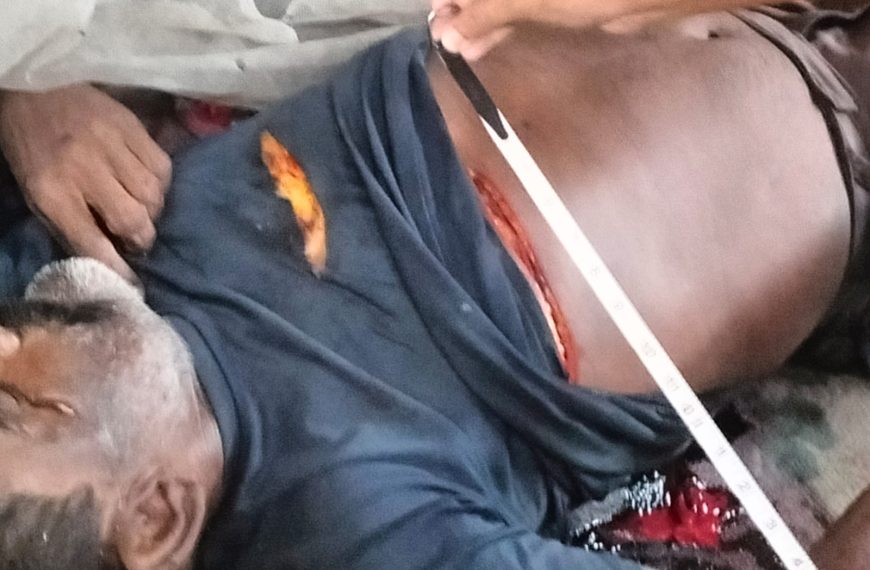 অশ্বিনী মার্কেটে রক্তাক্ত অবস্থায় দিনমজুরের দেহ উদ্ধার, খুনের সন্দেহে তদন্তে পুলিশ