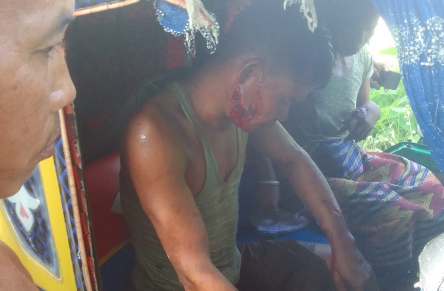 পাঞ্জীরায় ভাল্লুকের হামলায় আহত স্বামী-স্ত্রী